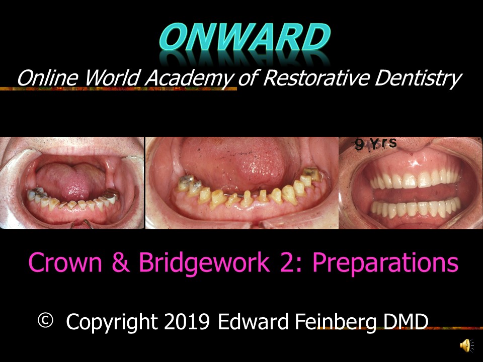 Crown and Bridge 2 - How to Prepare Teeth with Full Shoulder Preparations