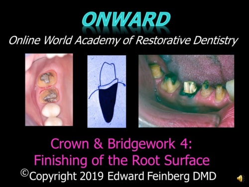 Crown and Bridge 4 - How to Prepare the Root Surface for Full Shoulder Crown and Bridge Preparations