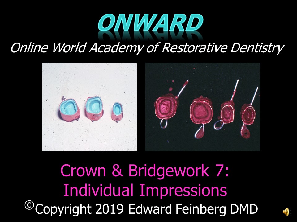 Crown and Bridge 7 - Indications and Techniques for Taking Individual Impressions of Prepared Teeth