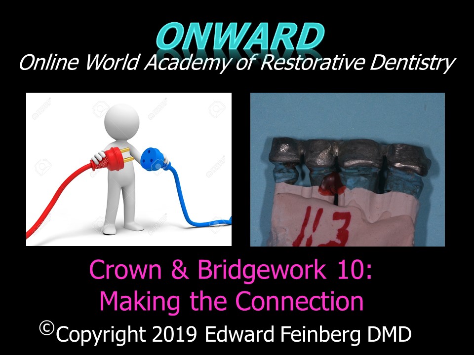 Crown and Bridge 10 - Rationale of Splinting for Prevention of Disease and Stabilization