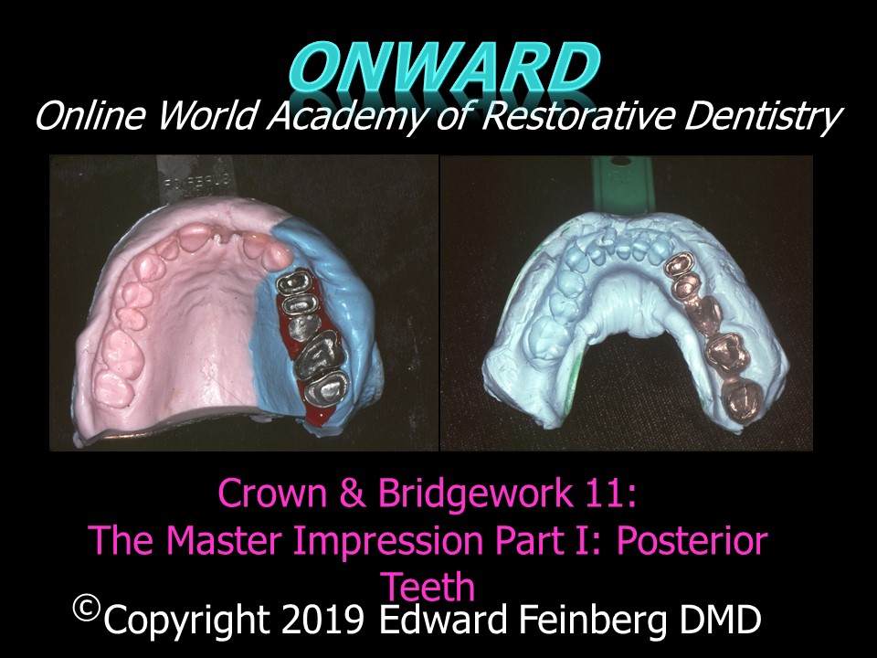 Crown and Bridge 11a - How to Make Accurate Master Impressions and Models for Posterior Single Crowns and Bridges