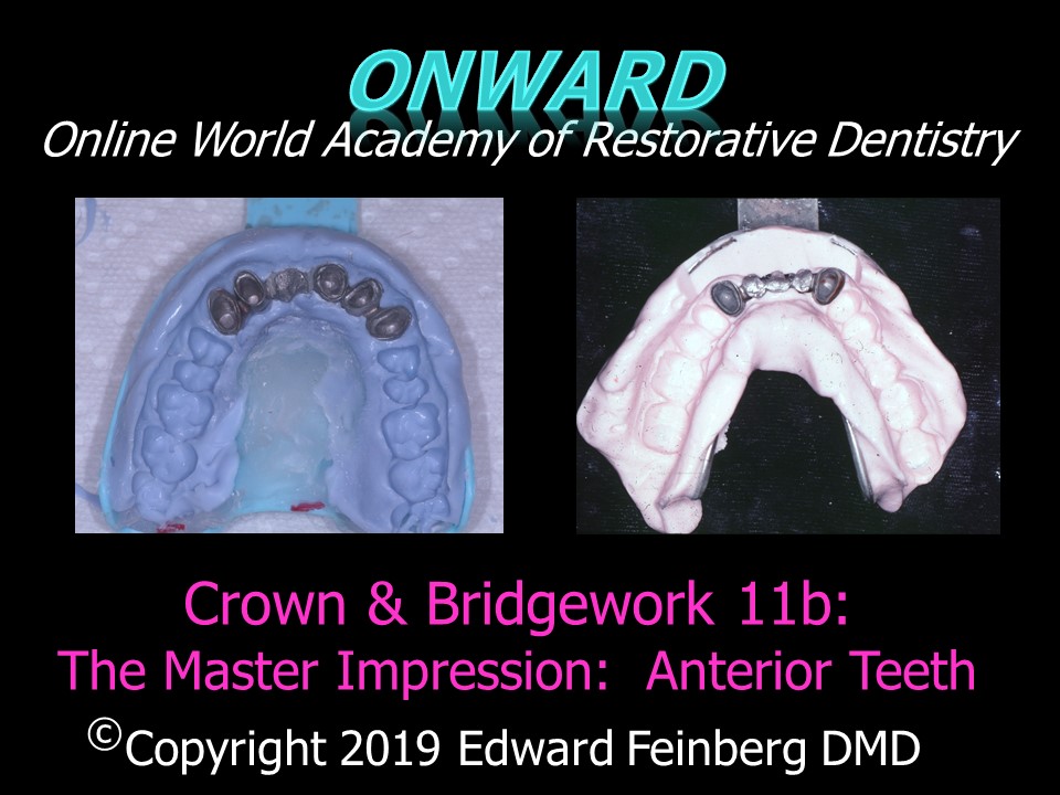 Crown and Bridge 11b - How to Make Accurate Master Impressions and Models for Anterior Single Crowns and Bridges