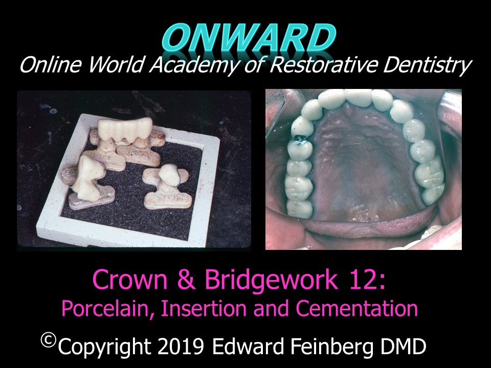 Crown and Bridge 12 - Procedures for Porcelain Try-in, Trial Insertion and Permanent Cementation of Fixed Restorations