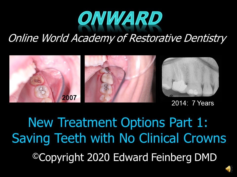 Saving Teeth with No Clinical Crowns Part I